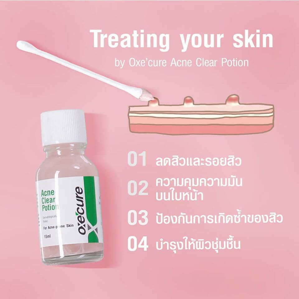 OXE'CURE Acne Clear Potion